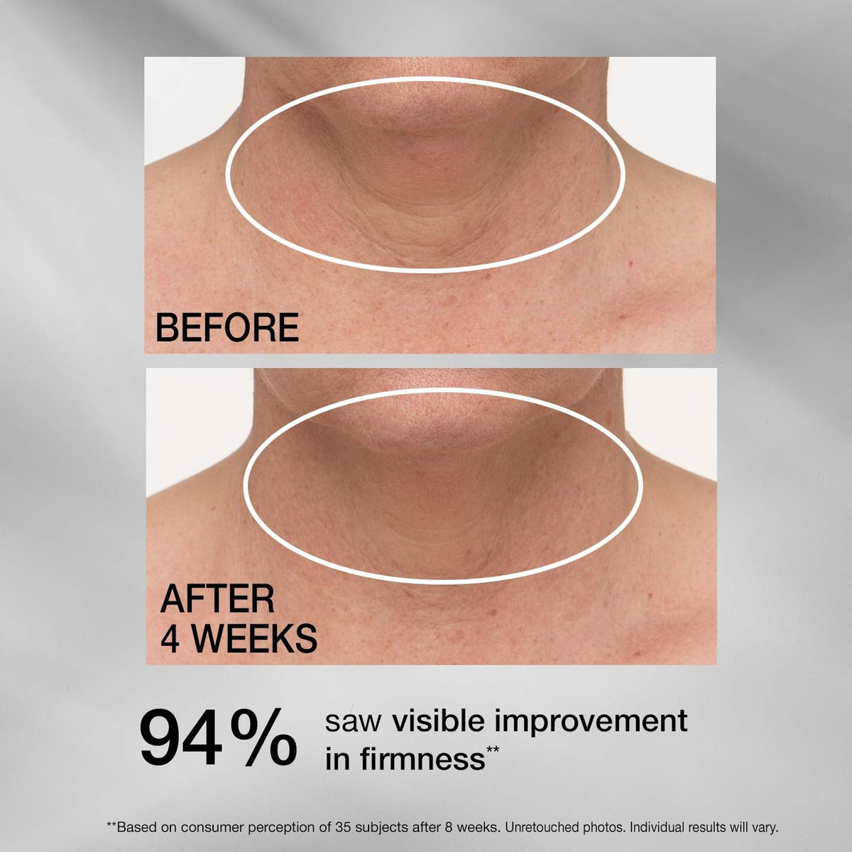 TL ADVANCED® TIGHTENING NECK CREAM PLUS